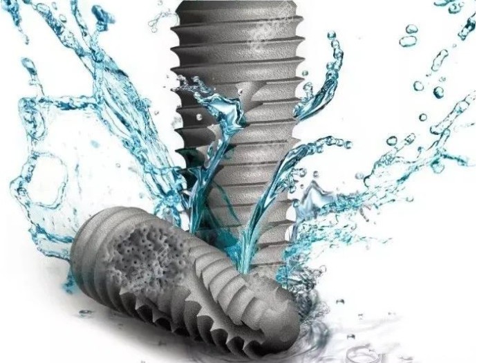 韩国奥齿泰US系列档次的价格