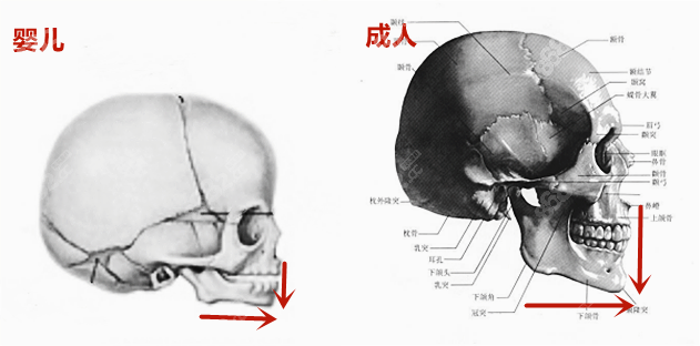 地包天牙性和骨性区别图片