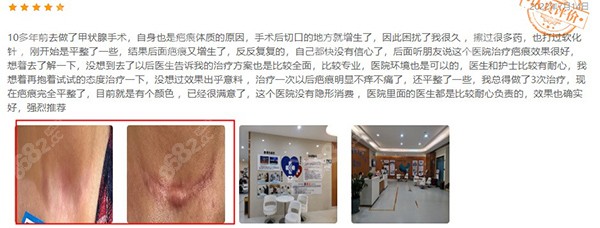 昆明昆大疤痕疤痕研究院治疗好不好口碑评价