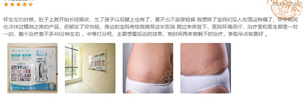 昆明昆大疤痕疤痕研究院治疗好不好