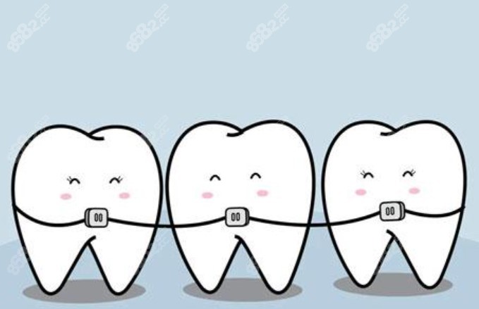 牙槽骨薄矫正牙齿的风险是什么
