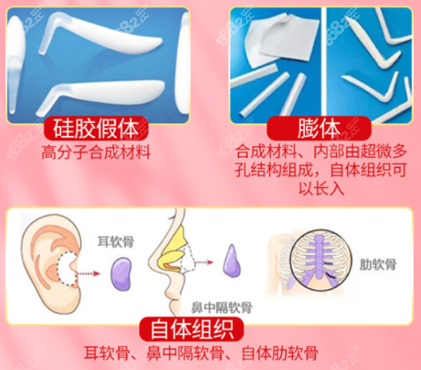 韩国will整形医院做鼻子修复多少钱