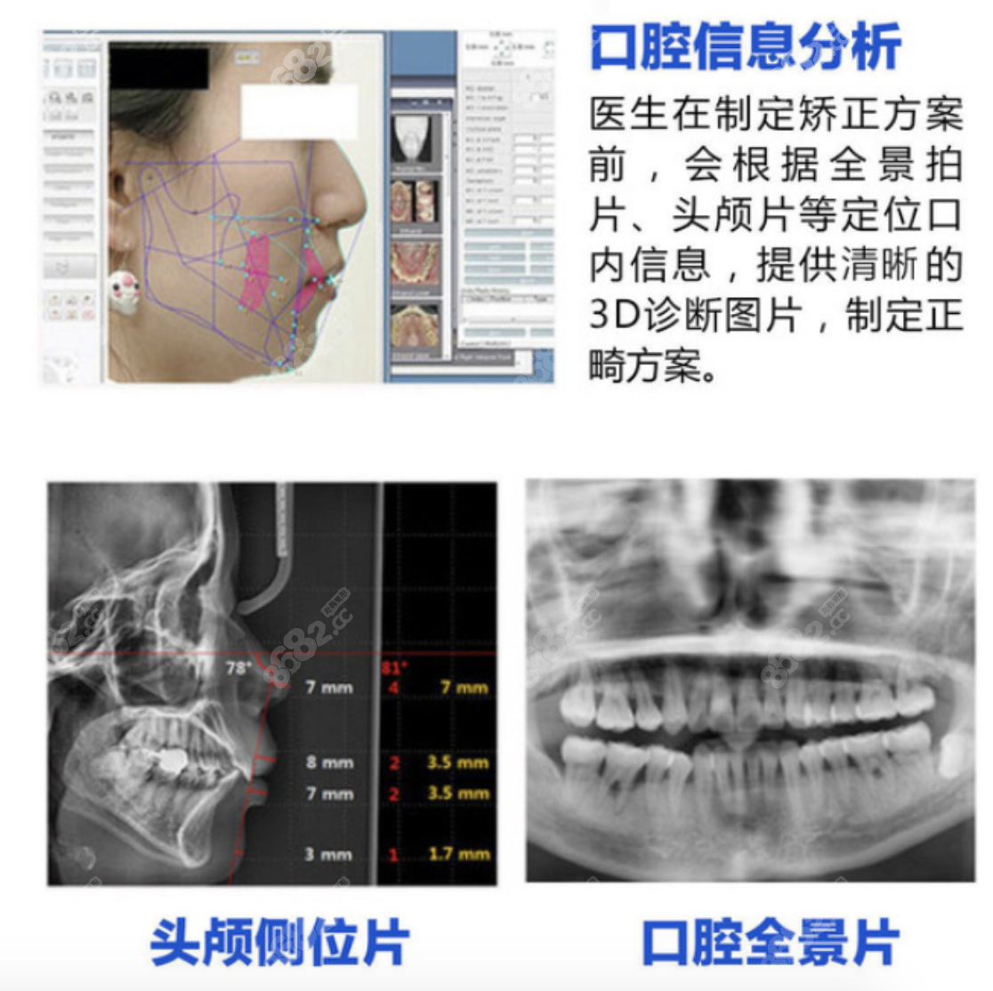 九江中山口腔医院矫正医生哪个好