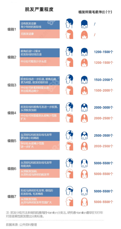 脱发植发价格表