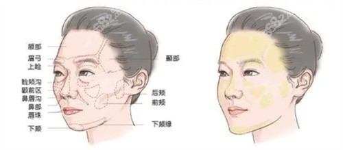 面部衰老分区示意图