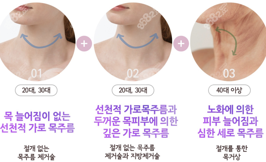 韩国延世多仁医院去颈纹技术优势介绍
