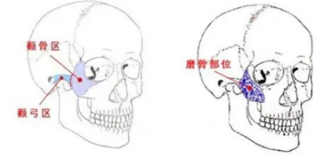 韩国欧佩拉