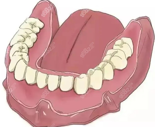 种植牙固定义齿和种植牙覆盖义齿的区别