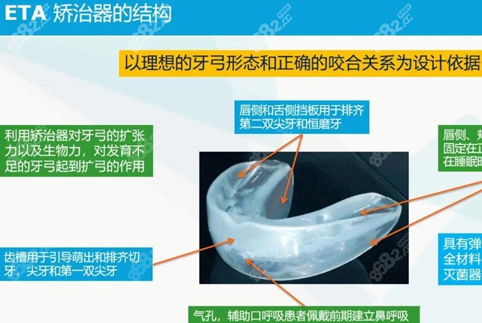 阳泉做儿童隐形矫正中的ETA矫治器