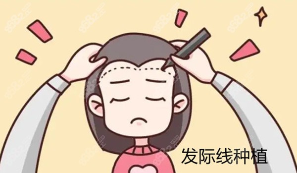 莱芜发际线植发价格