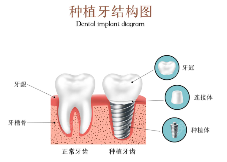 马鞍山牙百佳口腔种植牙怎么样