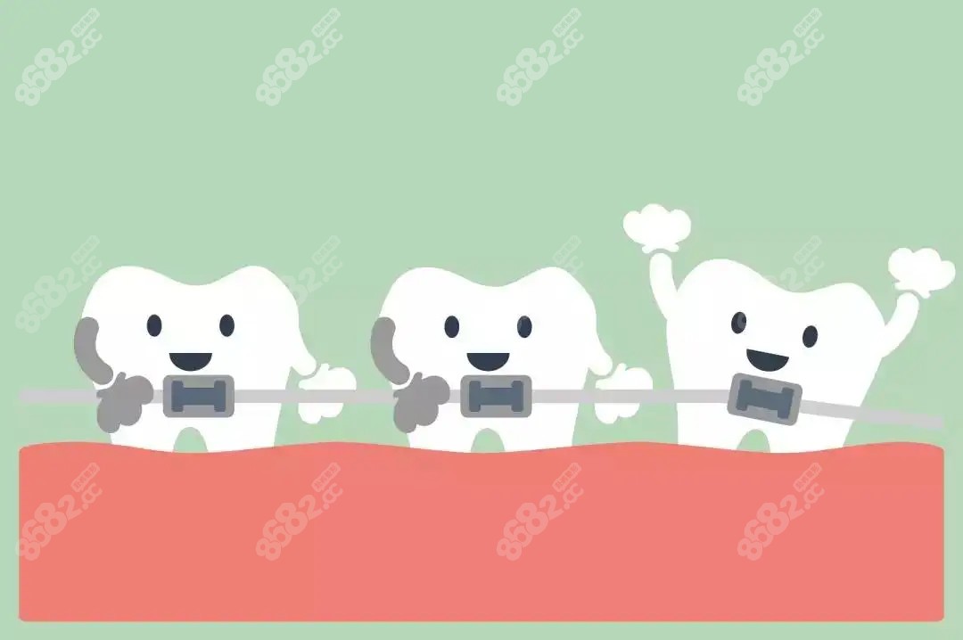 昌江牙齒矯正費(fèi)用多少