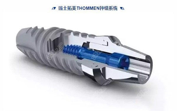 瑞士拓美种植体型号