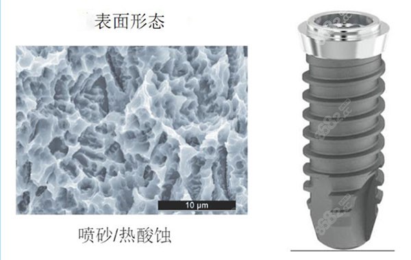 拓美种植体的优势