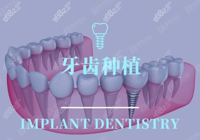 杭州雅莱齿科种植牙好不好