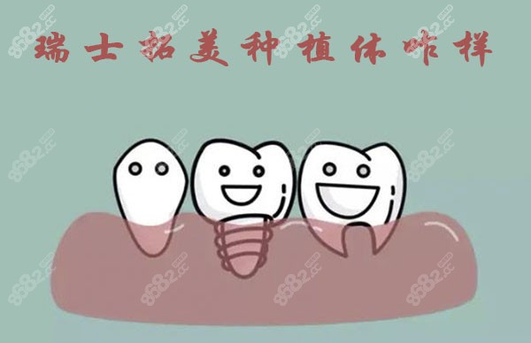 瑞士拓美种植体咋样