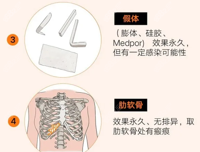 硅胶填充鼻基底会移位么