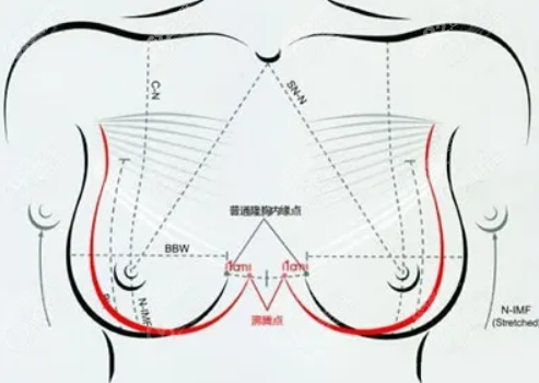 海峡沸腾丰胸美学设计