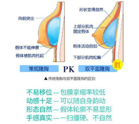 成都铜雀台隆胸技术怎么样