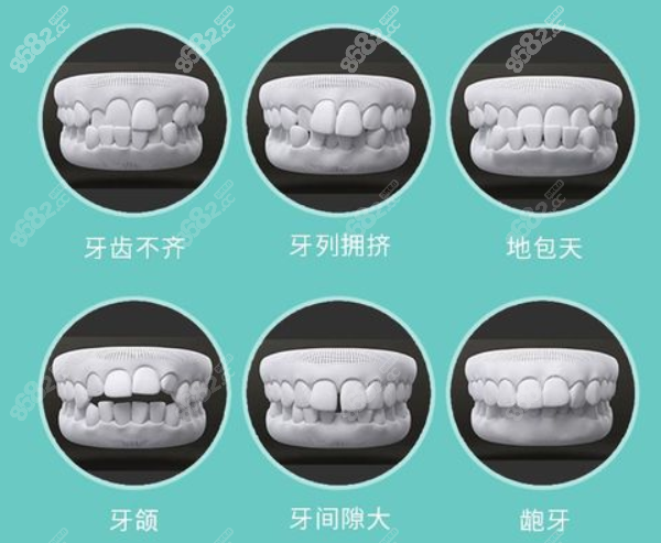 杭州优琦口腔正畸费用贵吗