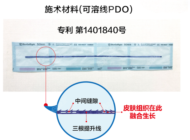 朴明旭的小切口三重提升怎么样