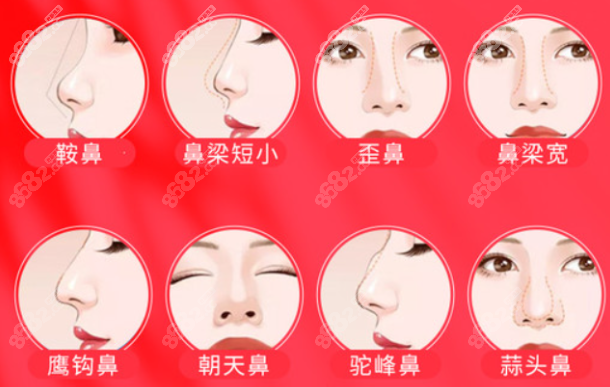 杭州清鍇整形做鼻子哪個醫(yī)生好