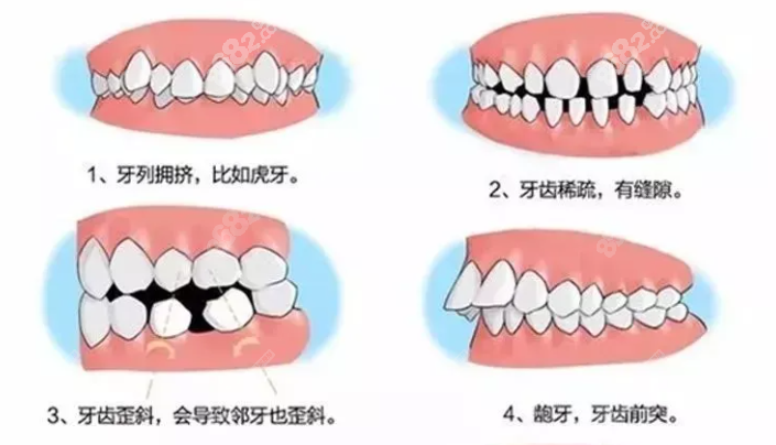 牙大夫周权医生面诊费多少