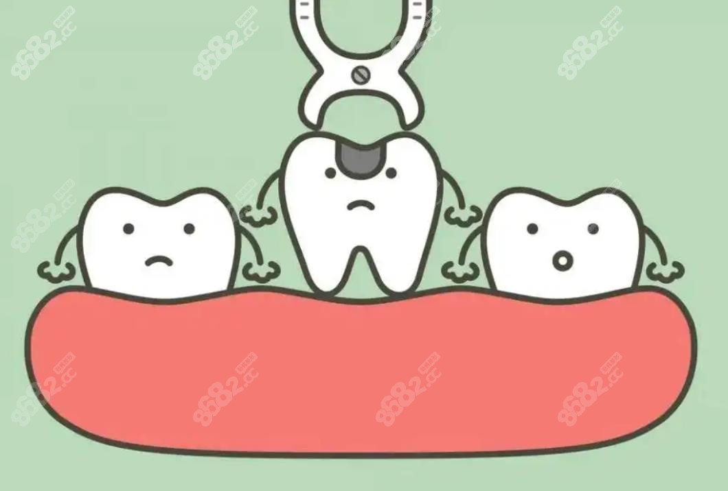 乌鲁木齐乳牙拔除60元左右