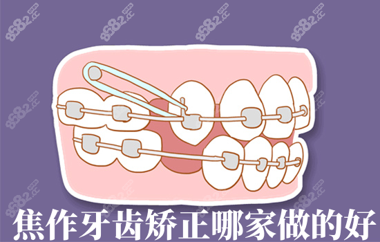焦作牙齿矫正哪家做的好