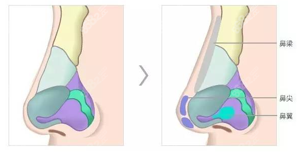 李保鍇醫(yī)生隆鼻技術(shù)怎么樣
