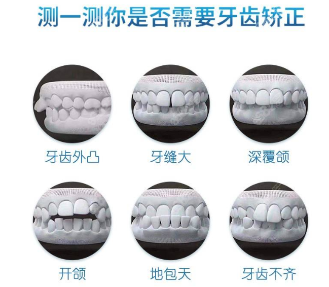 哪些牙齿需要矫正