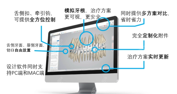 精靓隐形矫正的电脑设计