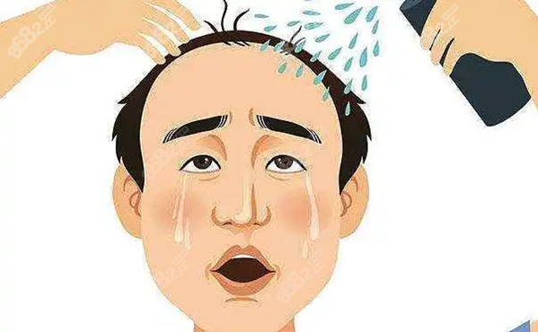 莆田哪里有植发治疗脱发的医院