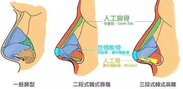 李晨耕隆鼻技术好