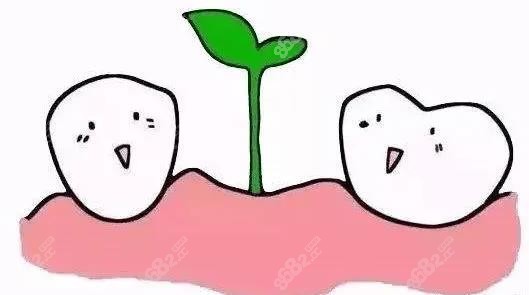 种植牙示意图8682.cc