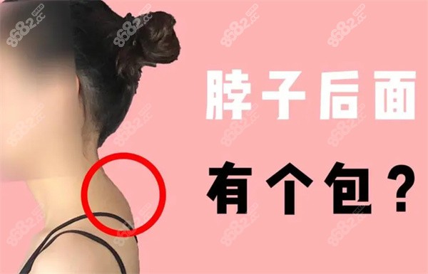 富贵包去除后还会再长么