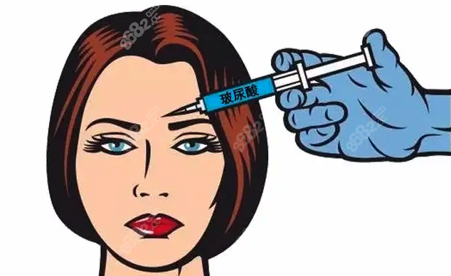 韩国纽拉玻尿酸注射填充咋样