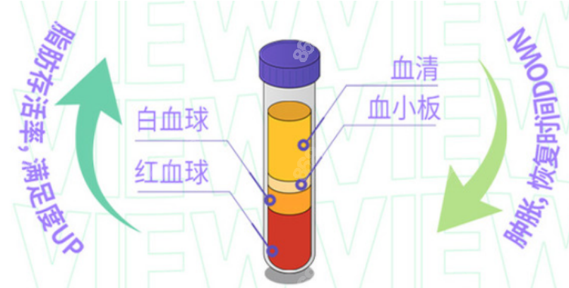 脂肪填充手术