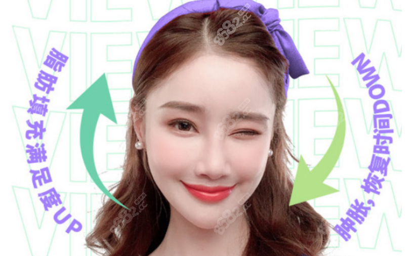脂肪填充手术
