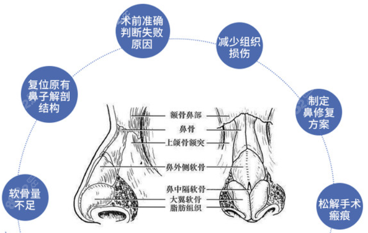 李保锴医生修复鼻子怎么样