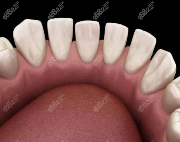 成人牙缝隙大吃东西老是塞牙怎么修复好m.8682.cc