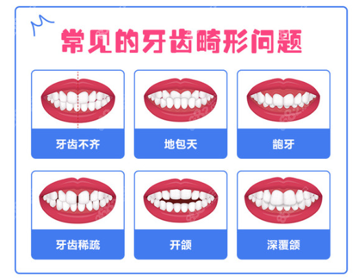 <!--<i data=20240705-sp></i>-->口腔常做的牙齿矫正类型图