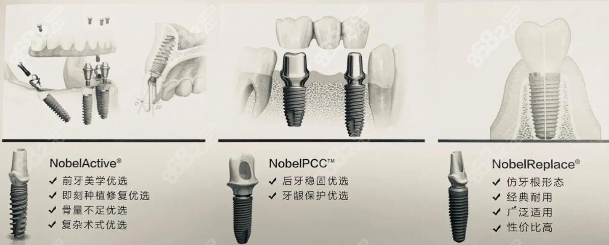 韩系进口植体经常使用到的品牌有哪几种