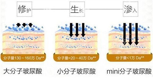 葡聚多肽填充面部好不好?