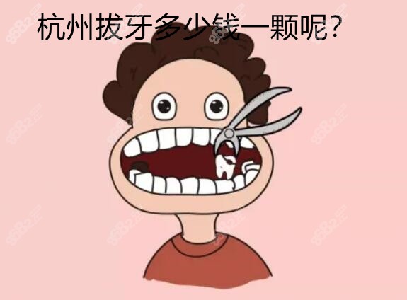 杭州拔牙多少钱一颗呢