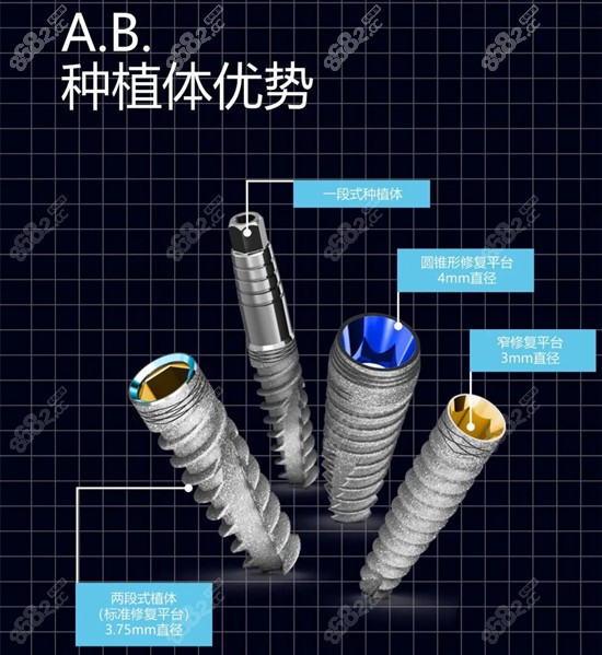 以色列ab种植牙的优点