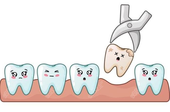 正常牙齿拔除卡通图