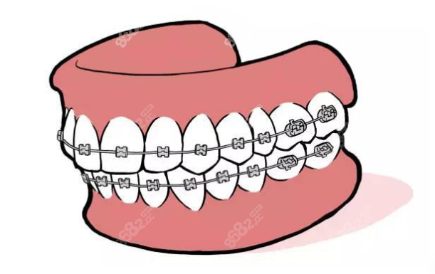 贵港戴牙套正规的医院