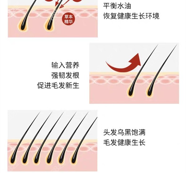 罗氏育发液到底治不治脱发www.8682.cc