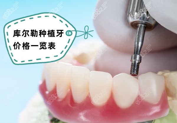 库尔勒种植牙价格一览表